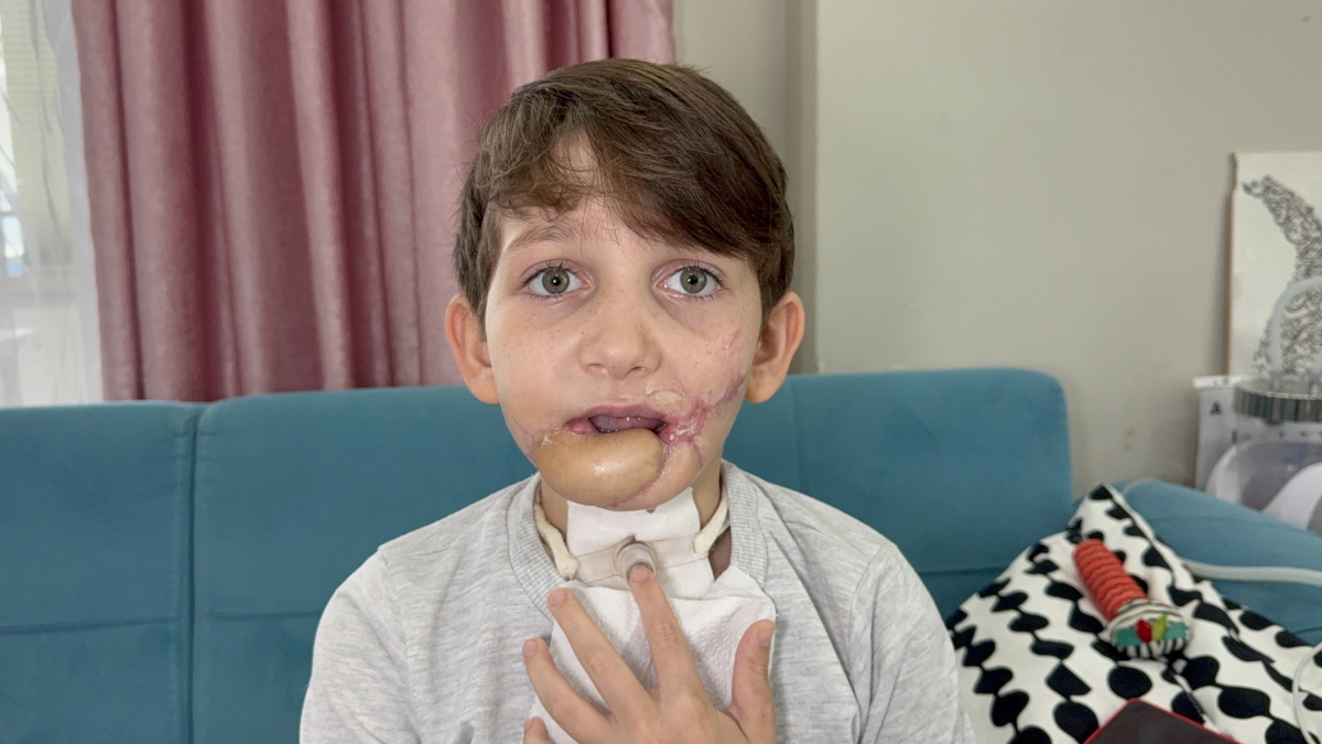 10 yaşındaki çocuk tüfekle çenesinden vuruldu, aile