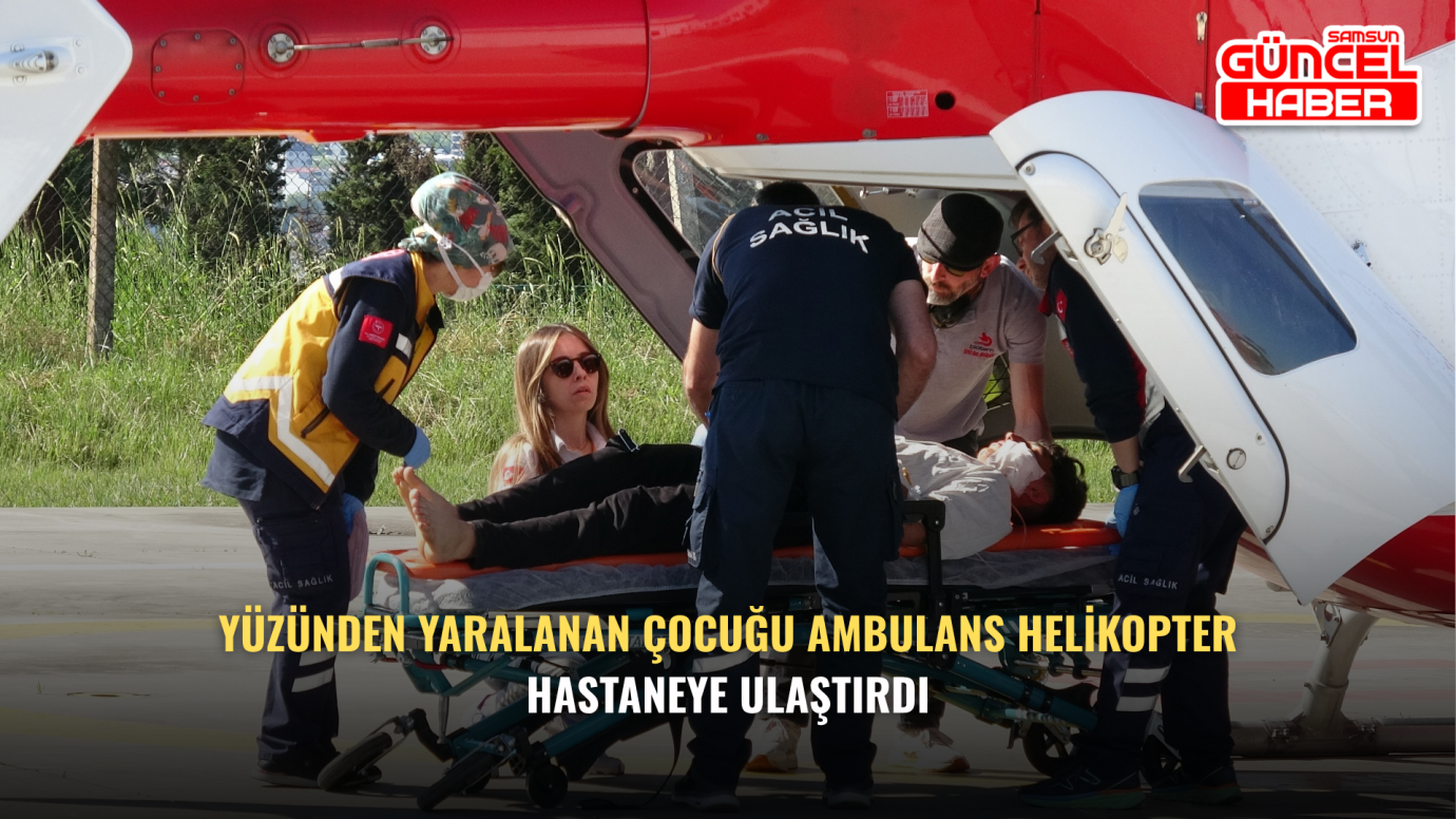 Yüzünden Yaralanan Çocuğu Ambulans Helikopter Hastaneye Ulaştırdı
