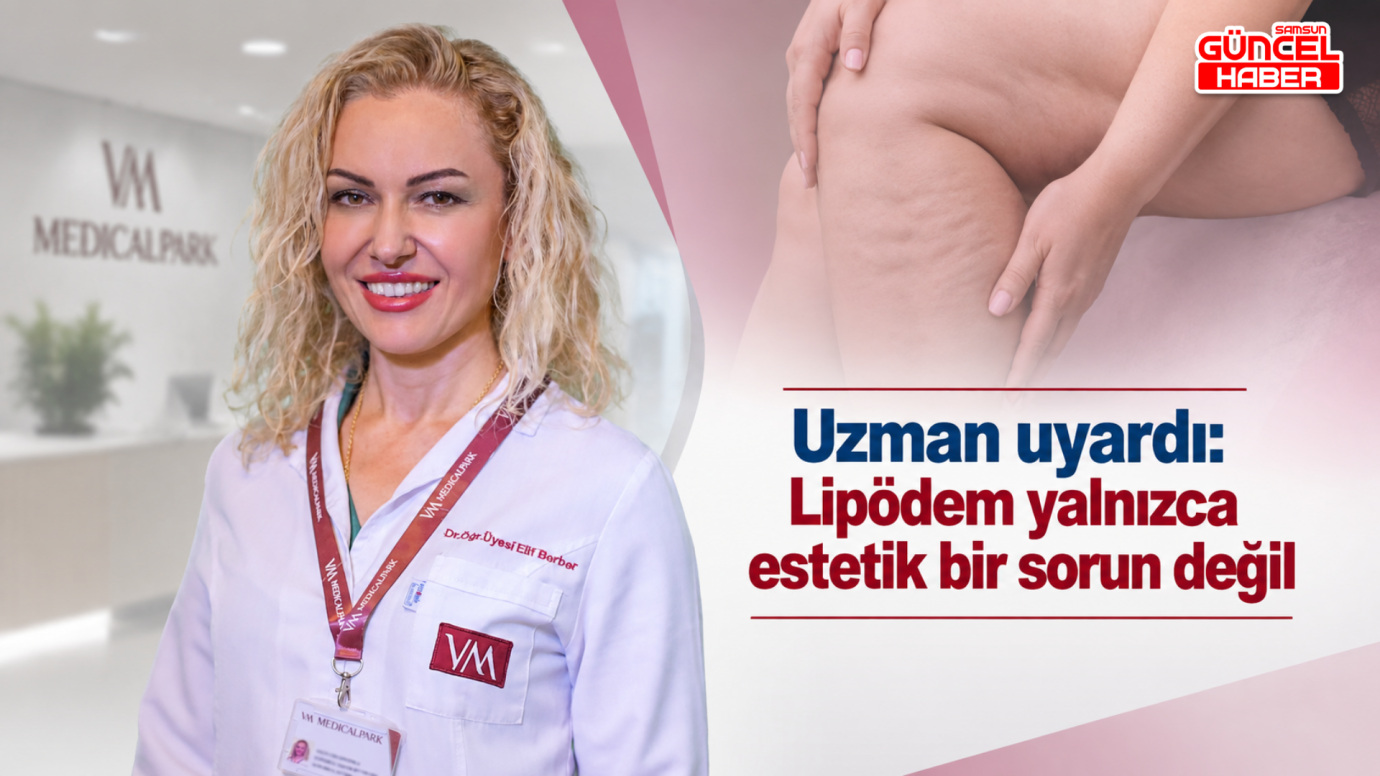 Uzman uyardı: Lipödem yalnızca estetik bir sorun değil