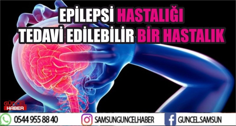 EPİLEPSİ HASTALIĞI TEDAVİ EDİLEBİLİR BİR HASTALIK
