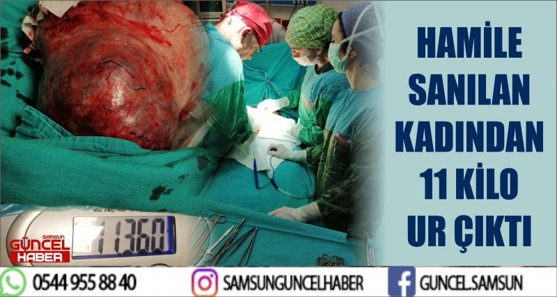 HAMİLE SANILAN KADINDAN 11 KİLO UR ÇIKTI
