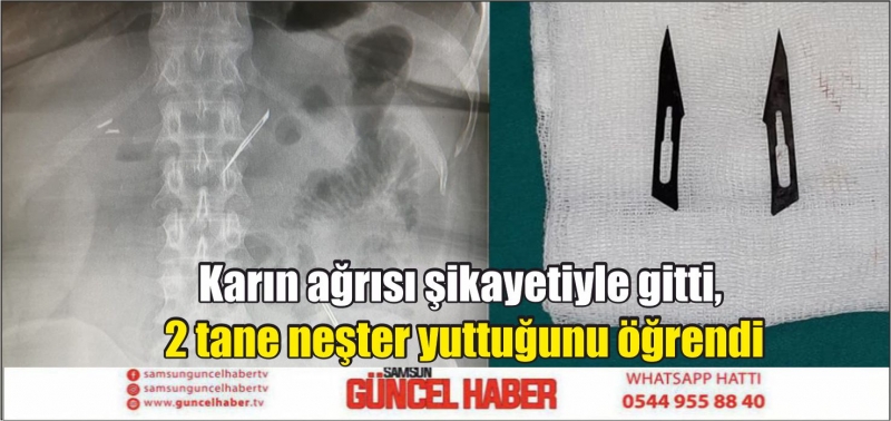 Karın ağrısı şikayetiyle gitti, 2 tane neşter yuttuğunu öğrendi