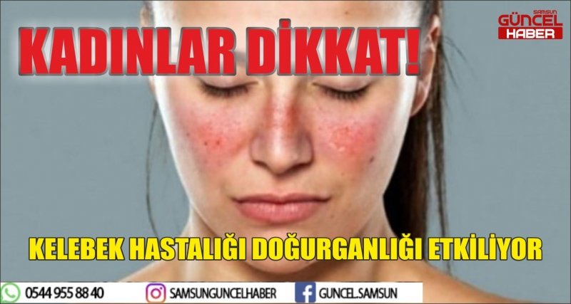 KELEBEK HASTALIĞI DOĞURGANLIĞI ETKİLİYOR