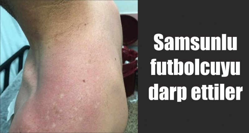 Samsunlu futbolcuyu darp ettiler