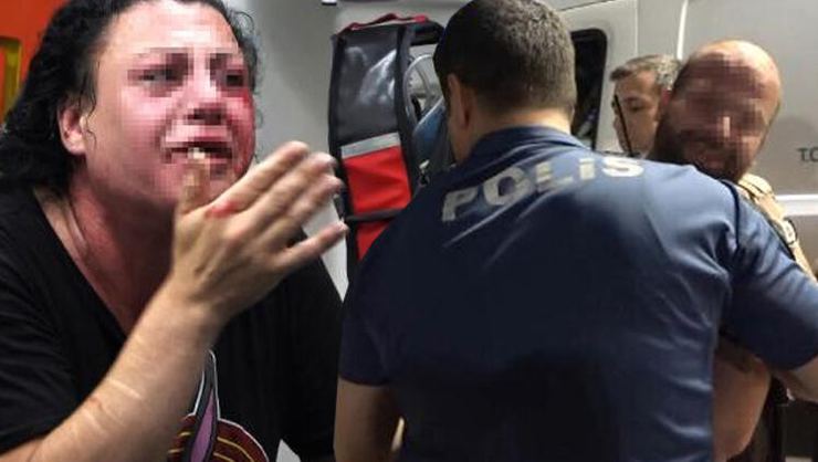 Transseksüel olduğunu öğrenince...