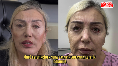 Ünlü estetikçiden Seda Sayan'ın ablasına estetik dokunuş