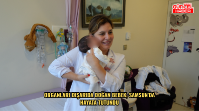 Organları dışarıda doğan bebek, Samsun'da hayata tutundu