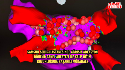 Samsun Şehir Hastanesinde ağrısız ablasyon dönemi: Genel anestezi ile kalp ritim bozukluğuna başarılı müdahale